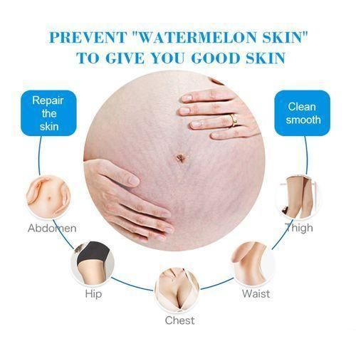 product_image_name-Aichun Beauty-Anti-Stretch Mark Essence Soap Removes Stretch Marks-4