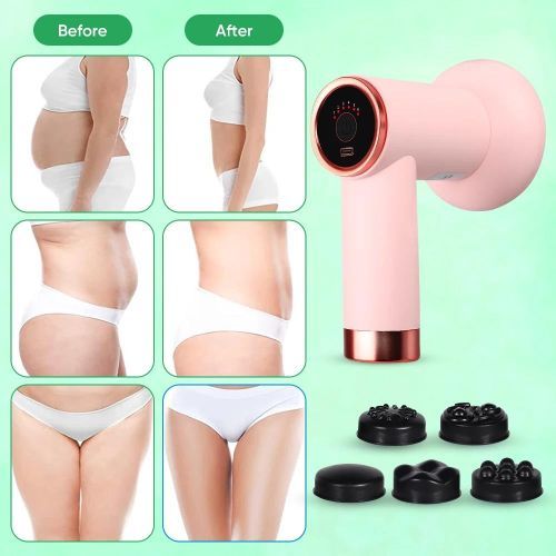 product_image_name-Generic-Handheld Cellulite Massager And Body Sculpting Machine-5