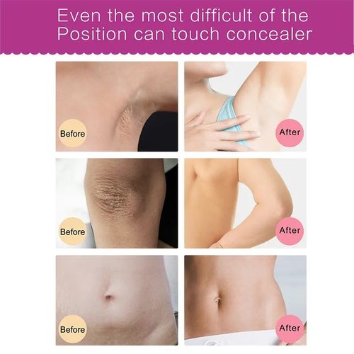 product_image_name-Generic-Elamei Effective Magic Whitening Cream - For Sensitive Areas-5