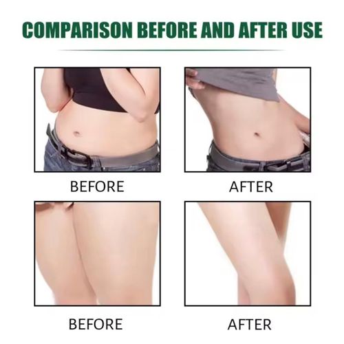 product_image_name-Generic-7 Days Body Weight Loss Belly Fat Burner Shaping Cellulite Burning Slimming Cream-4