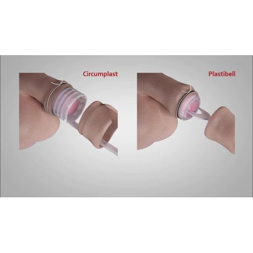 product_image_name-Generic-Plastic Bell  Circumcision Device-1