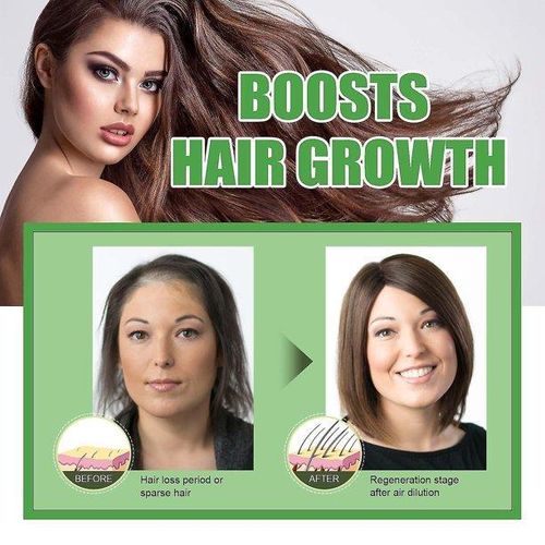 product_image_name-MOOYAM-Black castor oil ×3-2