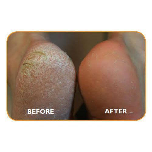 product_image_name-Herbal Skin Doctor-Balm For Rough, Dry And Cracked Feet/Foot Scrub-3