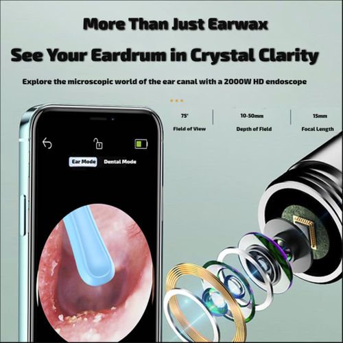 product_image_name-Generic-Smart Visual Ear Cleaner with 2000W HD Camera, Wi-Fi App Controlled Ear Wax Remover - Safe Otoscope for Home Use, Suitable for Kids & Adults (White)-5