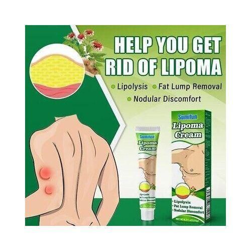product_image_name-Sumifun-Effective Lipoma Removal Cream/ Fat Lump Removal-1