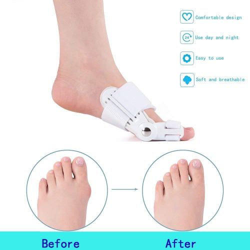 product_image_name-Generic-Orthopedic Bunion Braces Splint Regulator Relief Pain Big Toe Separators Straightener Feet Care Corrector Hallux Valgus-4