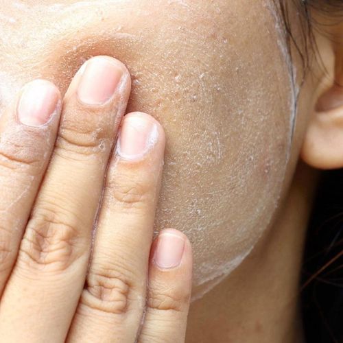 product_image_name-Generic-PanOxyl Acne Foaming Wash 10% Benzoyl Peroxide Maximum Strength 156g-6