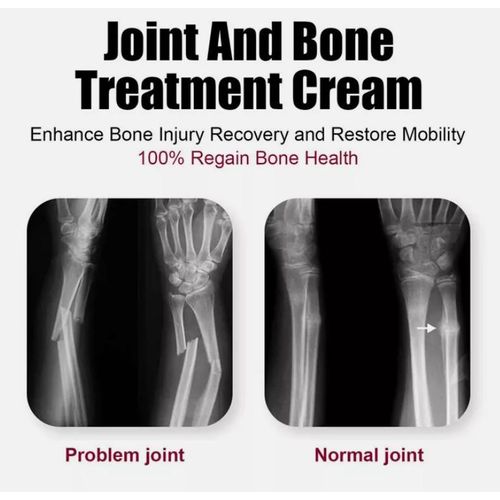 product_image_name-Generic-Perfectx FAST HEALING Joint & Bone Therapy Cream Perfect Pains Relief Cream for Muscle, Joint, Back, Ankle, Hands, Foot Perfect x Cream with Collagen, Vitamin K2 & MSM Concentrate for Joint and Muscle Recovery Provides Relief for Back Neck Hands Feet-2