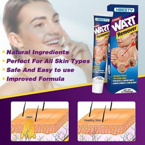 product_image_name-Generic-WART REMOVER ONITMENT-2