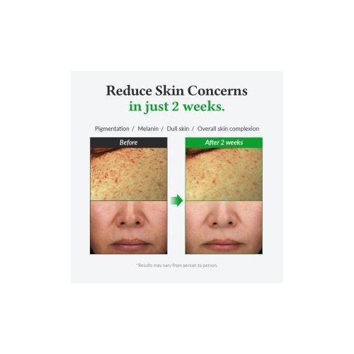 product_image_name-Generic-Dr. Althea Gentle Vitamin C Serum - 30ml-3