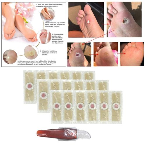 12 Patch Corn Sticker Callus Foot Cushion, Foot Corn Remover Pads