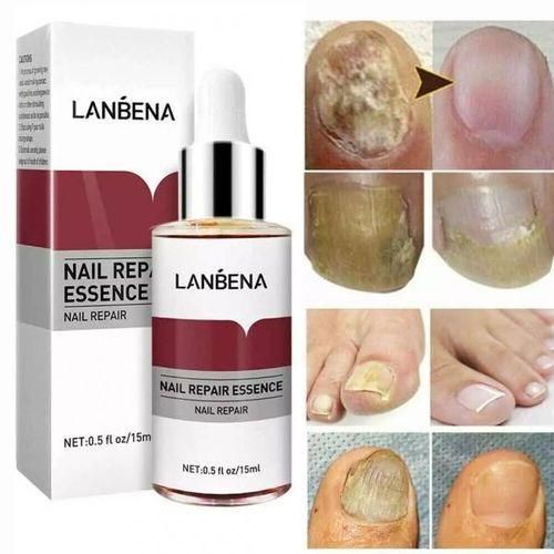 product_image_name-Generic-Lanbena Nail Repair Essence Remove-1