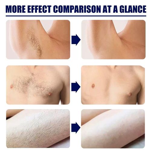 product_image_name-Eelhoe-NATURAL Men's Intimate Parts Hair Removal Cream Smooth Skin Mild Skin Hydration for All Skin Hair Removal Cream for Men,Painless Hair Removing Cream-3