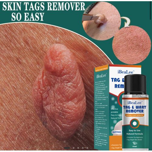 product_image_name-KanyeHB-Wart Remover Ointment,Fast Acting Cream Wart Gel Remover-1