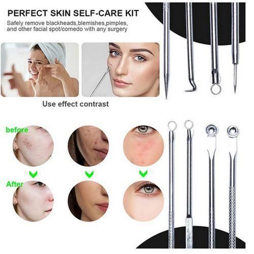 product_image_name-Generic-Acne Remover Tool  Needle  Cleaning Extractor-1
