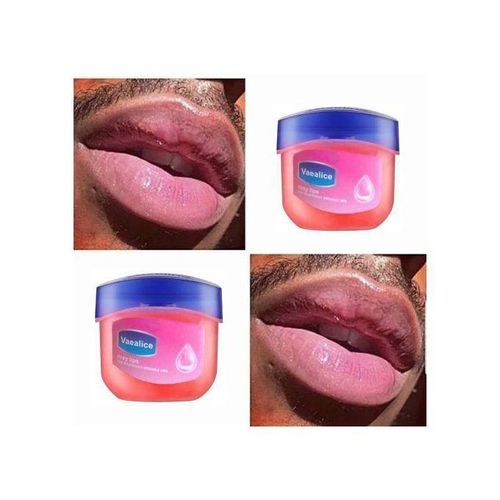 product_image_name-Generic-Pink Lip Balm Therapy For Pink Lips-1
