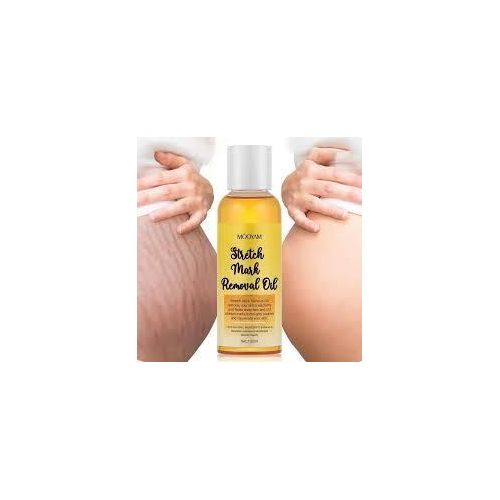 product_image_name-MOOYAM-Stretch Mark Remover Oil-1