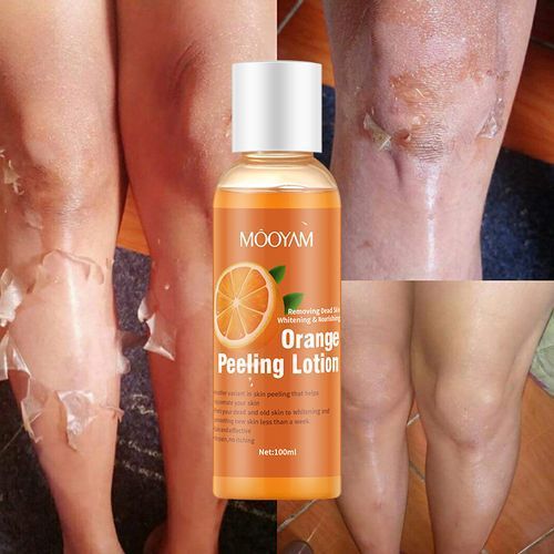 product_image_name-Generic-Orange Peeling Lotion Remove Dead Skin,Nourishing & Whitenin-1