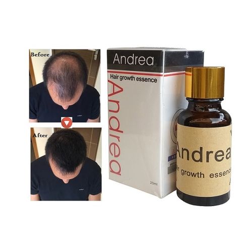 Andrea Hair Growth Essence Jumia Nigeria