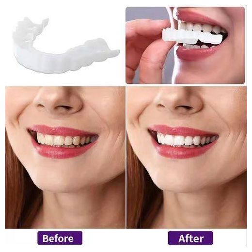 Generic  Tooth Cover Snap On Silicone Smile Veneers Teeth - image 3