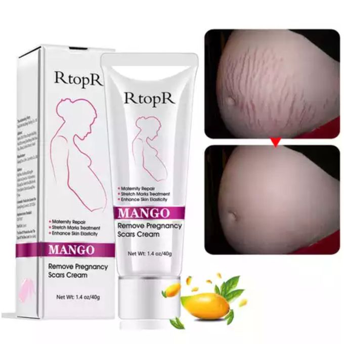 Rtopr Mango Pregnancy Scar Stretch Mark Removal Cream Jumia Nigeria