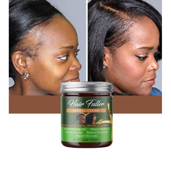 Generic Hair Fuller Herbal Hair Growth Cream | Jumia Nigeria