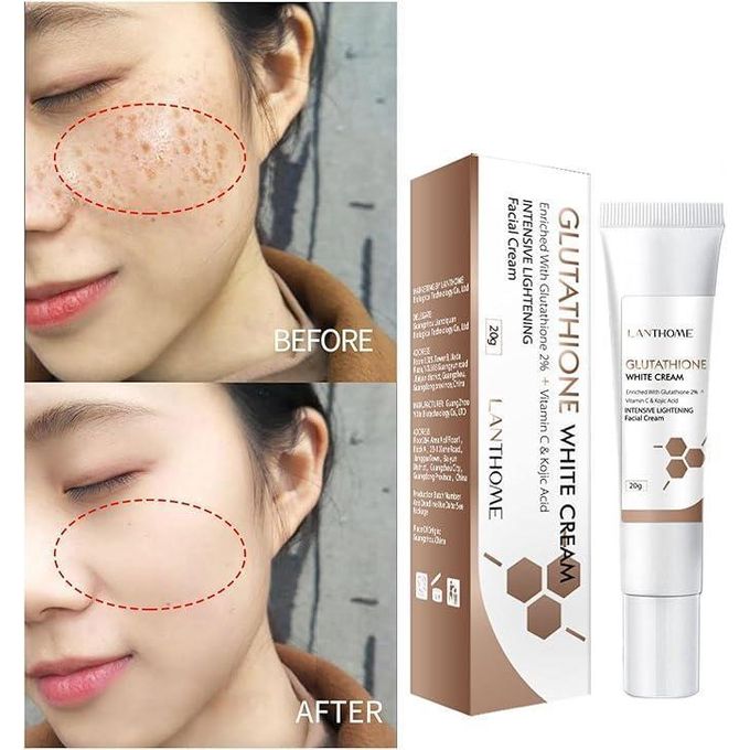 lanthome glutathione cream LANTHOME Collagen With Glutathione Whitening Cream facial moisturizers  Melasma Removal Cream Moisturizing Whitening cream Anti-aging Cream Anti  Wrinkle Cream Lighten Dark Spots Repair Damaged Skin Facial Cream - Lazada main image 1