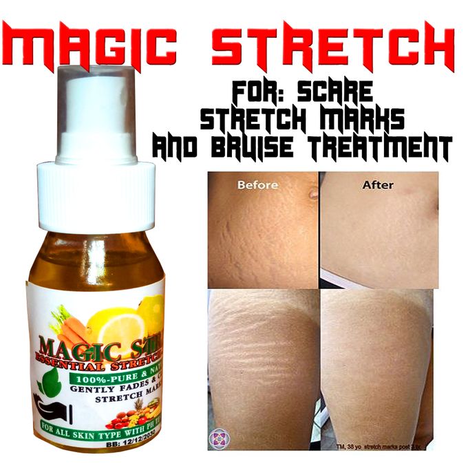 Fashion Stretch Marks Removal Essential Oil Jumia Nigeria