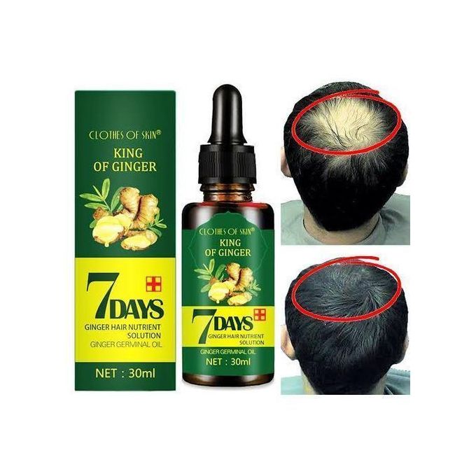 Ginger Hair Growth Oil in Nairobi CBD  PigiaMe