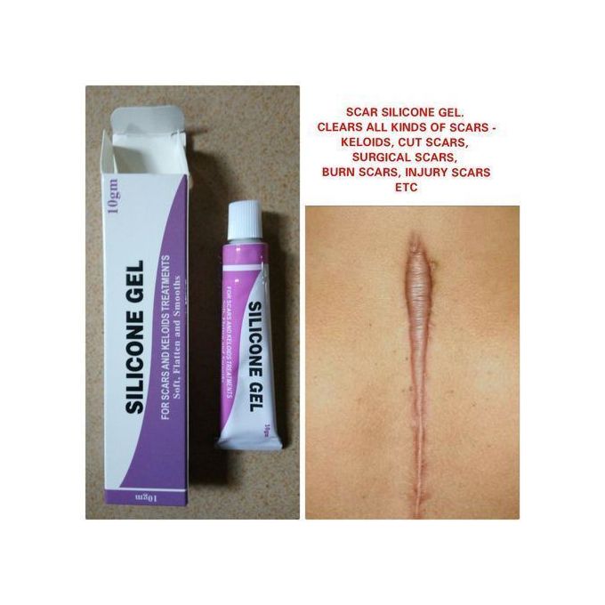 Silicone Gel Flattener-Ceasarean Section Scar/Wound/Keloid in Oshodi -  Skincare, Love City Global