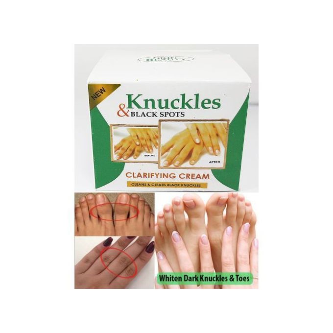 knuckles and cream