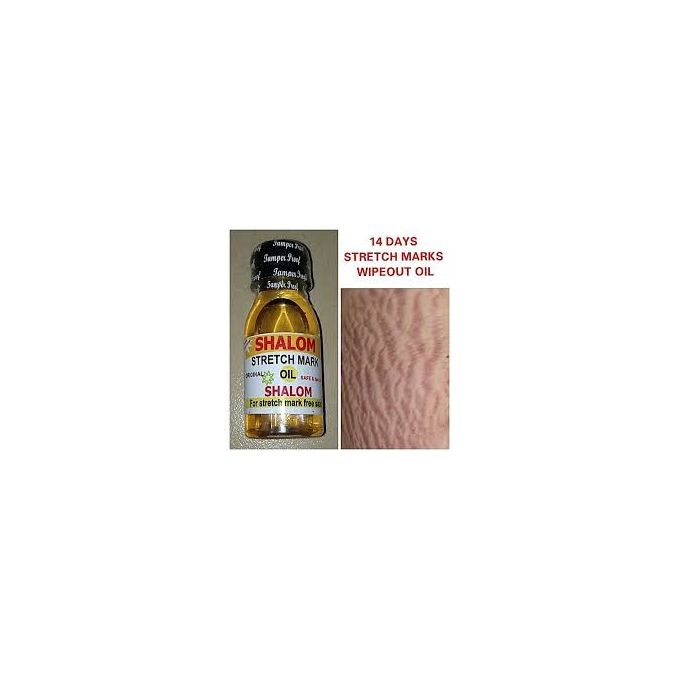 Shalom Stretch Mark Oil Jumia Nigeria