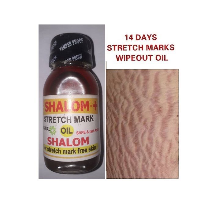 Shalom Stretch Marks Oil Jumia Nigeria