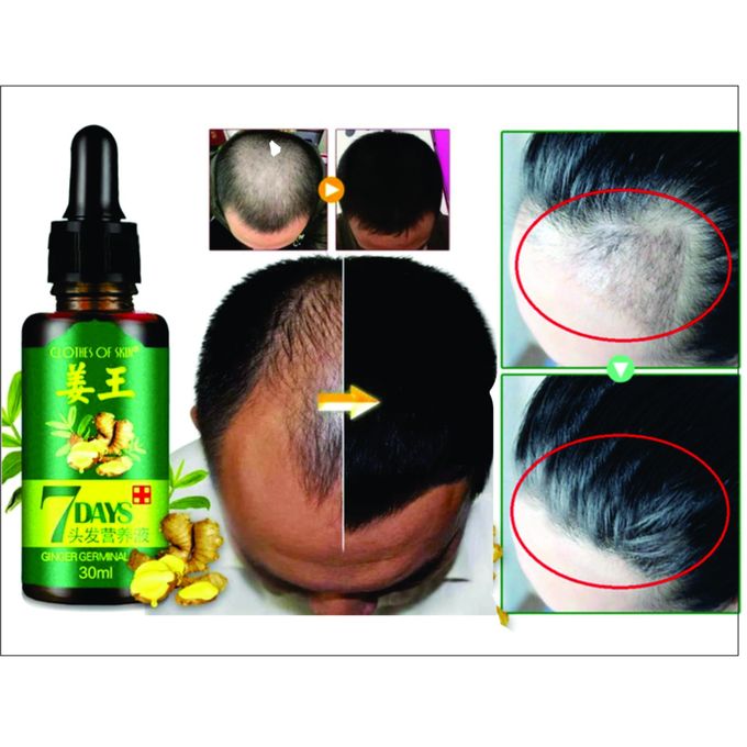 Clothes Of Skin Hair Growth Oil Serum 7days Quick Result ...