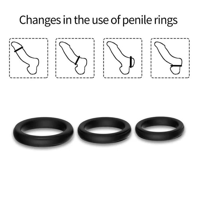 Erection Rings