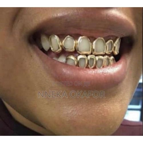 Gapped out gold teeth grillz