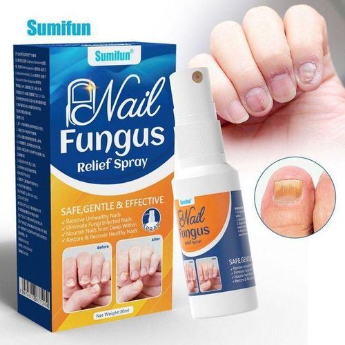 Nail Fungus Treatment Spray For Toenail & Finger Nail, Toe Nail Fungus Treatment Extra Strength, Foot Fungus Treatment - Fungal Infection Treatment Spray Remove Unhealthy Nails & Eliminate Fungi Infected Nails
